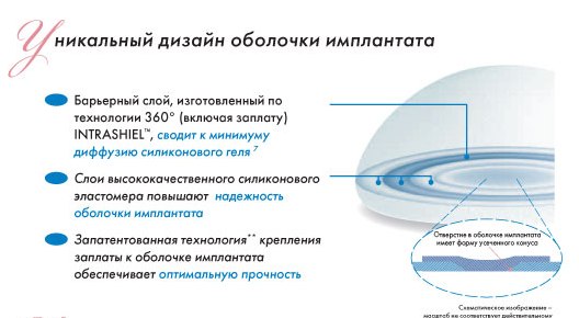 строение импланта для увеличения груди Natrelle