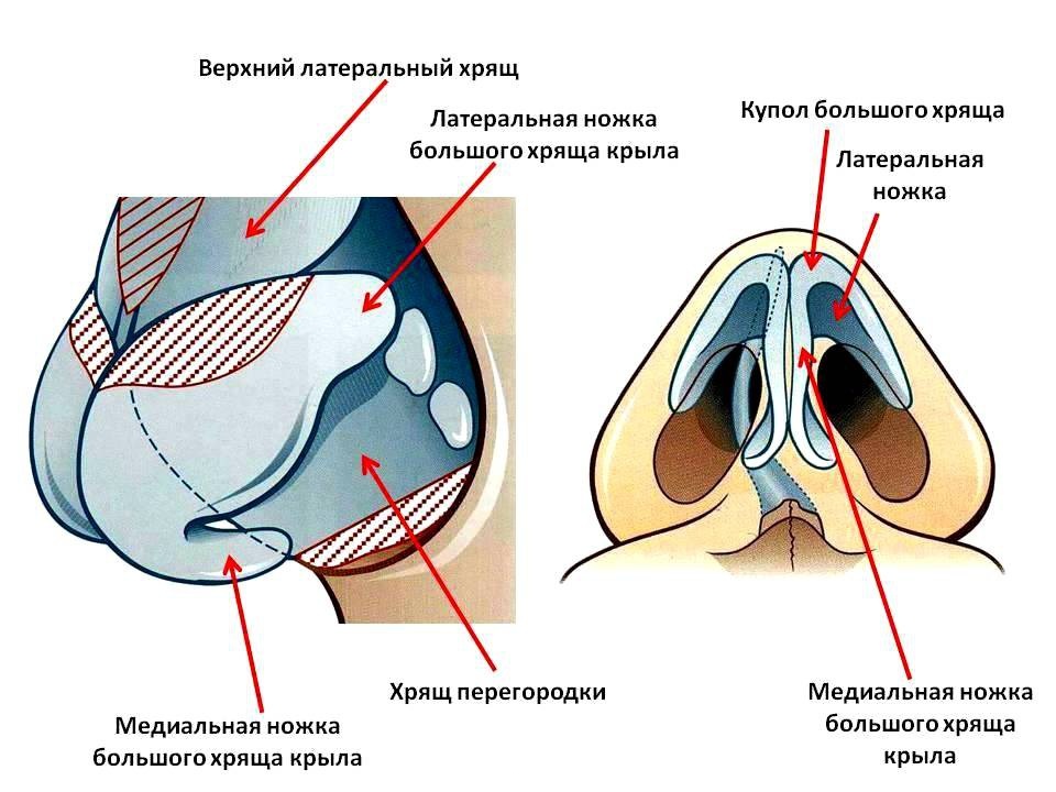 Анатомия и возможности пластики спинки носа